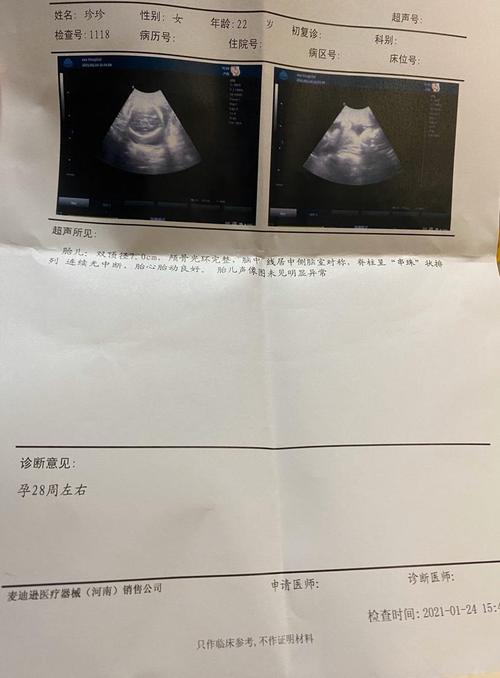 怀孕27周 今天去做产检单子上显示28周