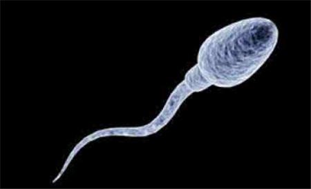 【正常精子图片】正常精子是什么样子的图片_正常精子