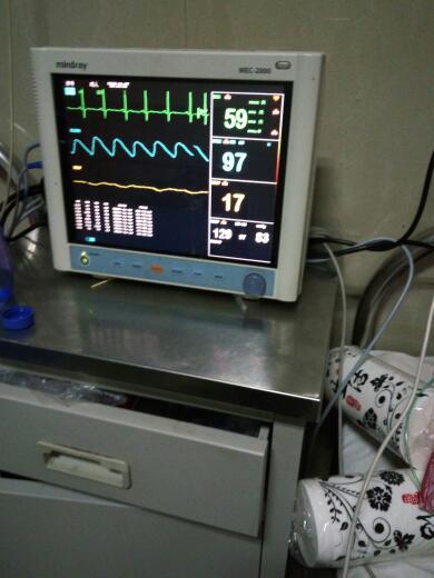 展开全部 心电图是不会显示血压的,你说的可能是心电监护,像电脑一