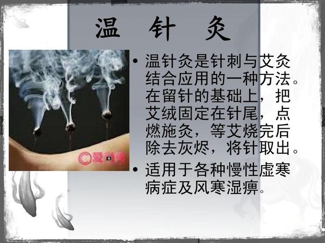 中医特色疗法-灸法ppt