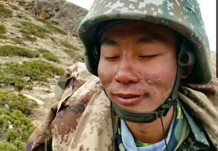 这些满脸沧桑被晒掉皮的人是我们驻守在青藏高原边防线上的战士