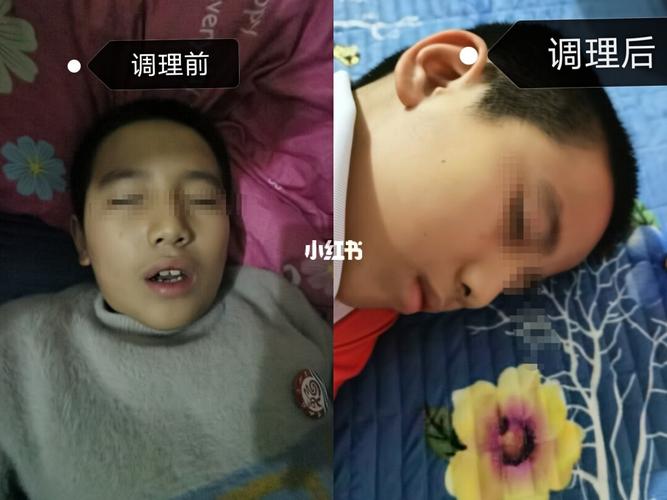 腺样体肥大终于调理好了_鼻炎_口臭_万物之源怎么样_鼻炎腺样体肥大