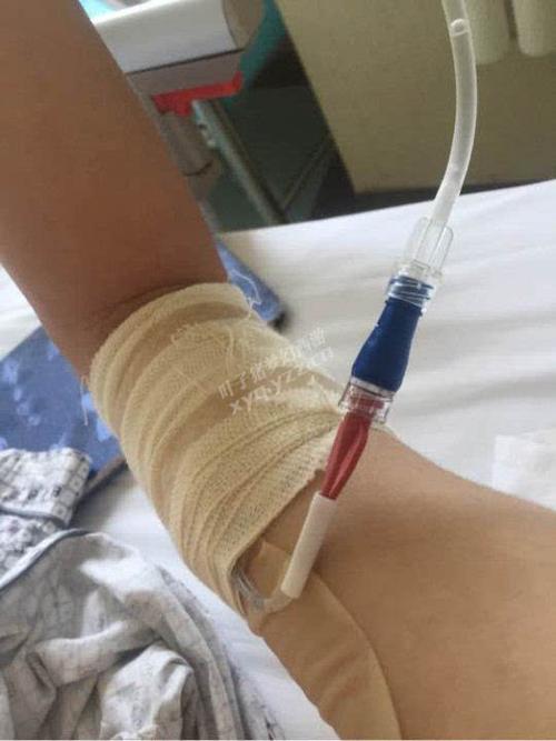 梦幻玩家身患白血病开始化疗 爸妈倾尽一切了