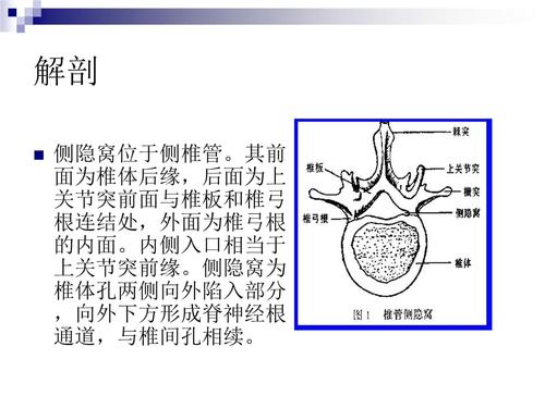 侧隐窝狭窄专题知识讲座培训课件.ppt 11页