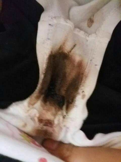 这是月经初潮吗? 感觉好可怕