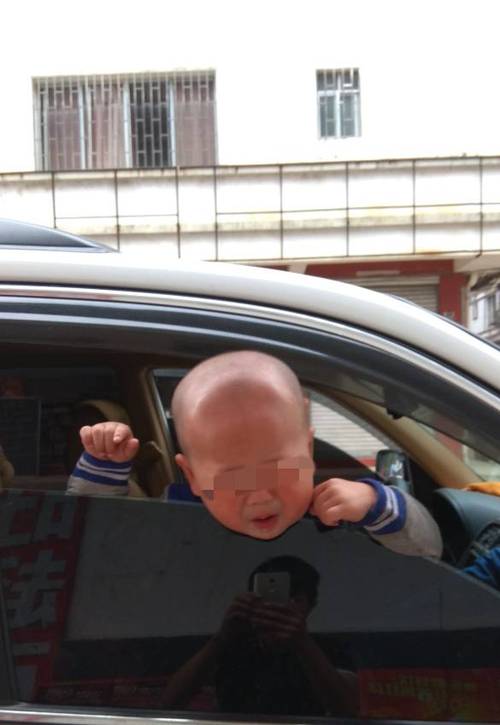 ⑤前额高突,形成方颅.