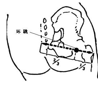 环跳穴(gb30)是足少阳胆经的经穴,穴近髋关节,故