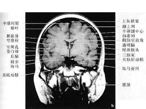 第22页 (共63页,当前第22页) 你可能喜欢 颅脑解剖 mri读片 磁共振
