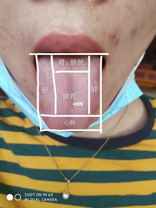 舌诊学习_医疗健康_医疗健康其他
