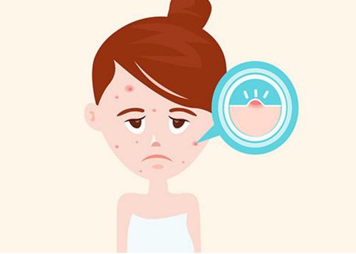 了解祛痘心得战痘干货