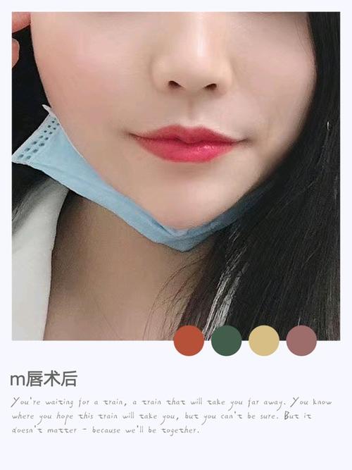 m唇术后前后对比照,这个效果我还满意!