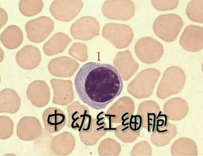 中幼红细胞