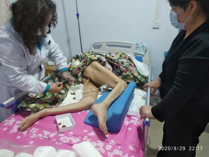 给卧床老人尿管消毒