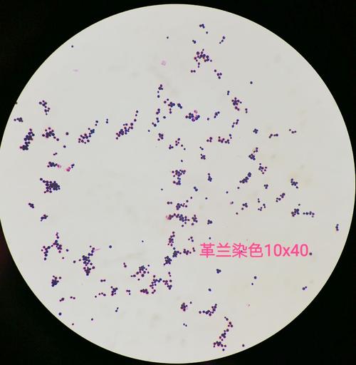 新型隐球菌— 来自穿刺液标本