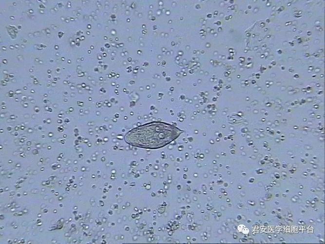 尿液中存在的,会是什么寄生虫吗? 查了许多资料,想起了一张质控图.