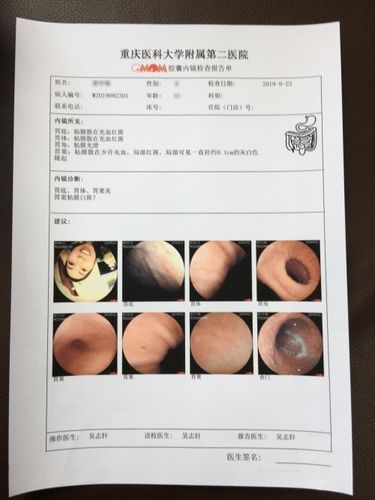 在胃部检查现场,受检者穿戴记录仪,一杯清水吞服胶囊,卧于检查床.