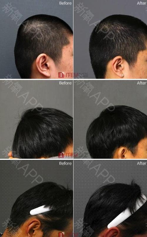 【小姐姐课堂之后脑勺也要美美哒】