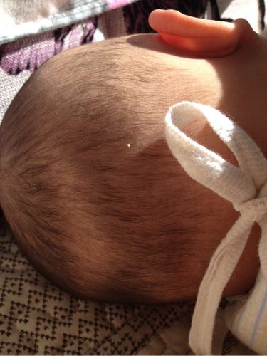 宝宝头发长的慢!