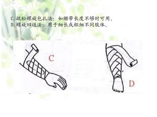 疏松螺旋包扎法:如绷带长度不够时可用. d.