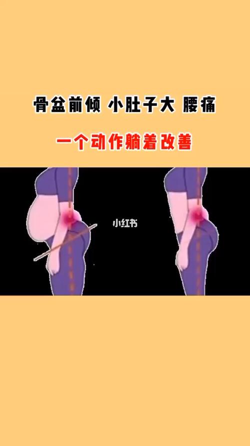 骨盆前倾_骨盆前倾_产后_母婴_妈妈经验
