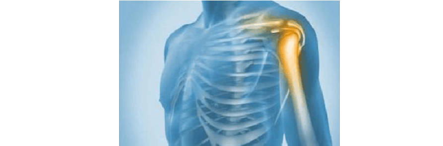 肩关节脱位怎么进行手法复位