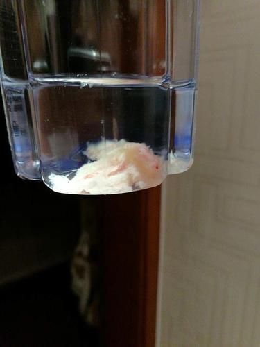 鼻子里擤出的肉状物,请学医的同学看一下是什么,.