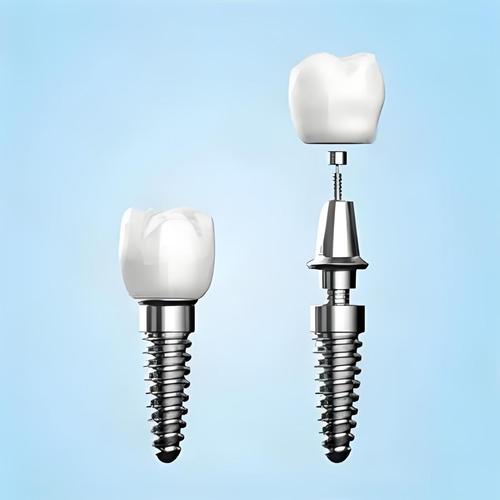 瑞士百丹特种植牙 6 大规格全解析!一文教你匹配适合的型号!