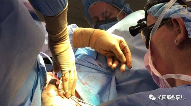 这个18岁的女孩,把自己变性手术的全过程,拍成了纪录片.