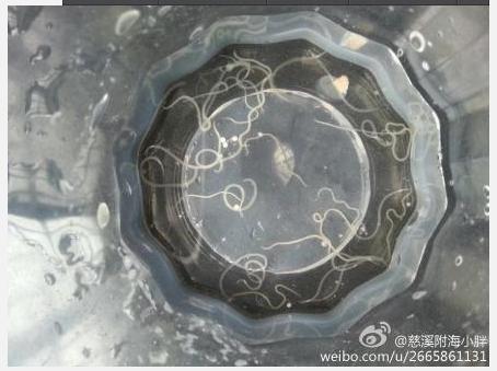 注意:部分海鲜,河鲜里面有寄生虫!