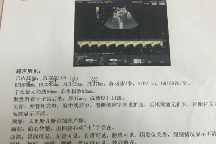 生个猴崽崽:我刚怀孕时在一个诊所做的b超,孕周和自己算的对的上.