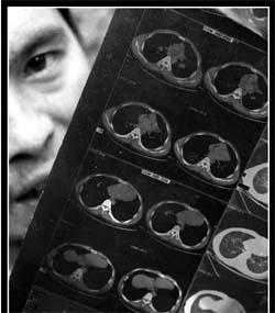 山阳尘肺民工的艰难诉讼路组图