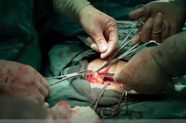 子宫缝完了,   开始缝腹腔.