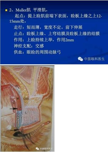 眼眶的解剖(最全面的图文详解)