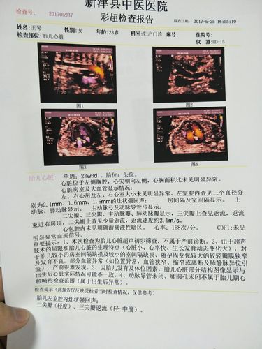 二尖瓣轻度,三尖瓣反流轻-中度.这种严重吗?要怎么办