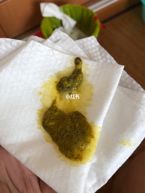 牛奶蛋白过敏3(内有大便图,慎点)_奶粉_过敏_牛奶_优博怎么样_后怎么