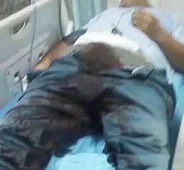 搞笑 正文  24岁小伙子居然亲自动手术割掉自己两颗"蛋蛋", 还将"蛋蛋