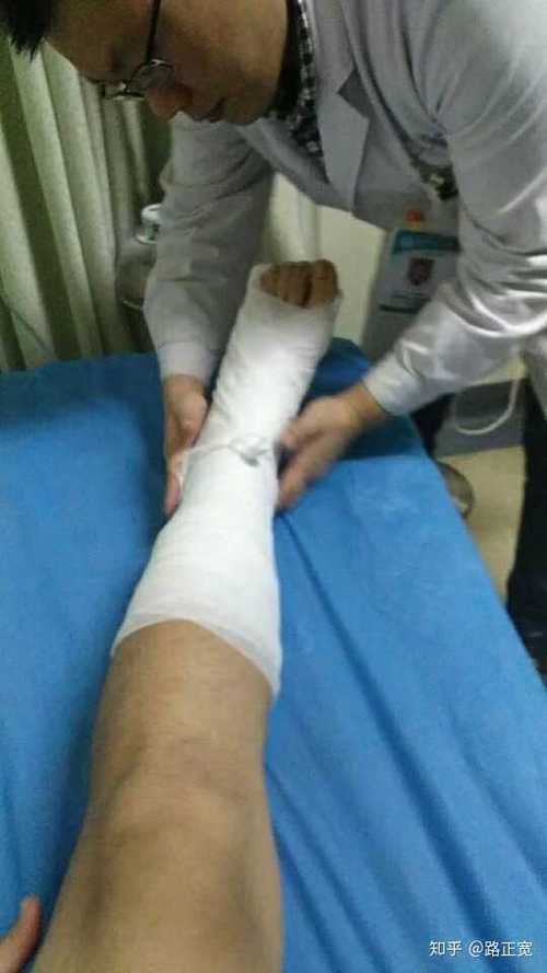 受伤的时候一生给我打石膏(刚打完球的脚还把人家熏到了 )