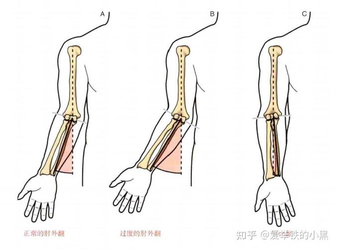 肘外翻有什么影响