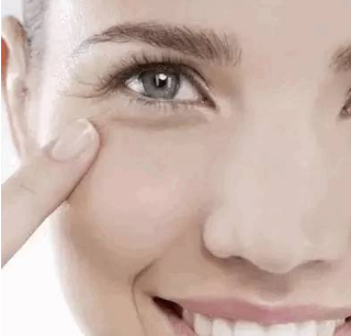 眼部干纹真的能去掉吗区分干纹细纹皱纹