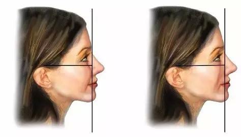 苹果肌虽好,也不能过量啊