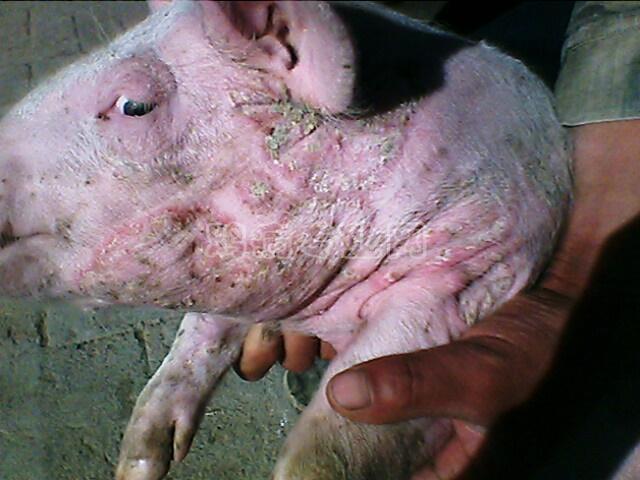 玫瑰糠疹(银屑样脓疱性皮炎)