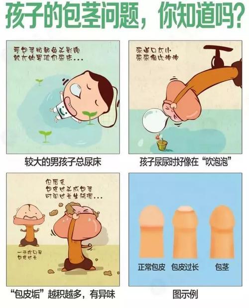 " "医生,孩子做了这个手术 最新资料显示, 有80%的男孩存在不同程度的