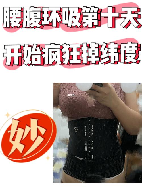 腰腹环吸第十天 | 瘦了一大圈7715_腰腹_环吸_塑身衣_吸脂_茵奇坊