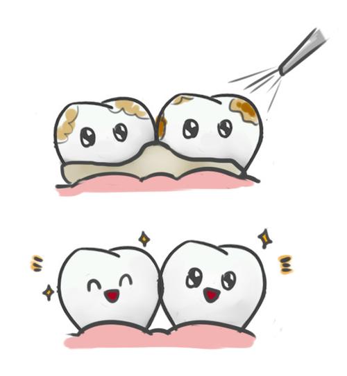 洗牙!真不是你想的那样