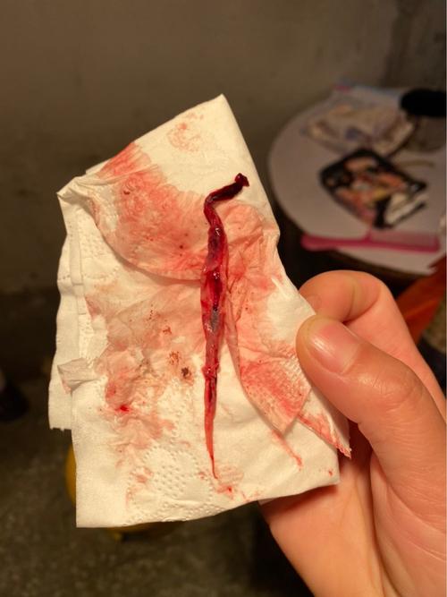 姐妹们这是流下来的胚胎吗?外面有一层白色裹着