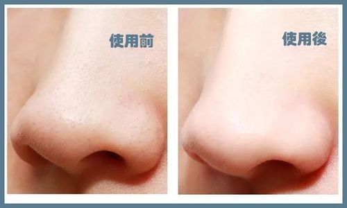 轻松搓一搓,10s温和补水去角质,死皮,黑头,还你白皙嫩
