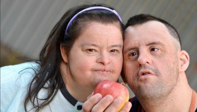 为什么唐氏综合征,几乎都长得一样?看完我懂了