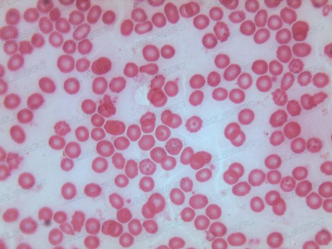 白细胞,红细胞等要在哪种显微镜下才可以观察到?