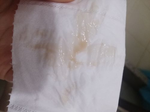 宝妈们,这个分泌物颜色是先兆流产症状吗?