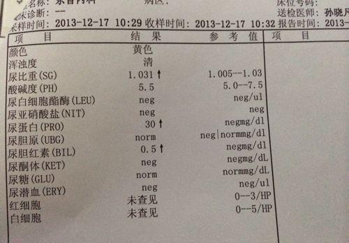 体检报告中,"尿蛋白 "是什么情况?会不会是什么病的前兆?